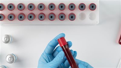 خبر حلو.. إنشاء مصنع إسباني جديد لإنتاج مشتقات البلازما في مصر